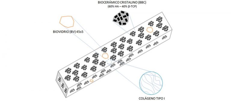 Crean con cordón umbilical un material para regenerar hueso