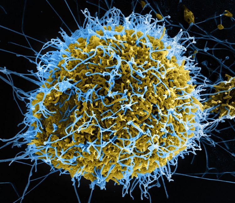 Micrografía del virus Ebola.