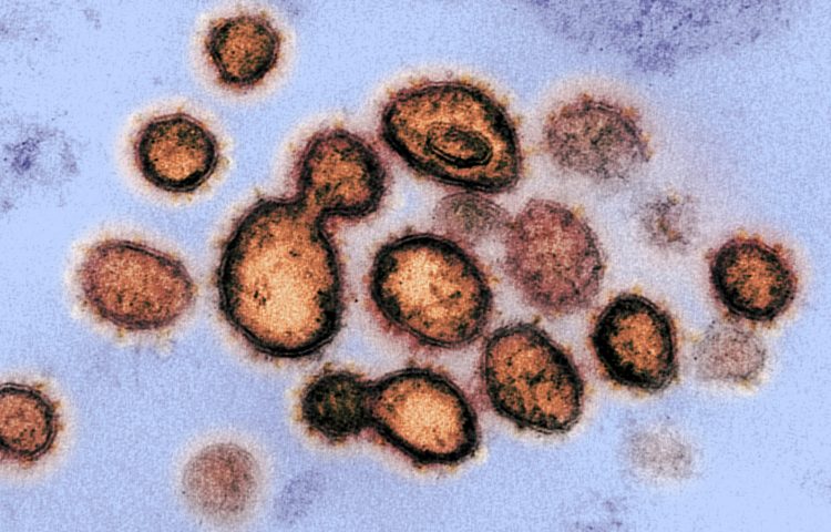Esta imagen, obtenida con un microscopio electrónico de transmisión y divulgada el 27 de febrero de 2020 por los Institutos Nacionales de Salud de Estados Unidos, muestra al virus SARS-CoV-2, causante de la COVID-19