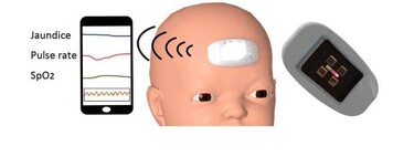 El primer wearable para bebés que monitorea con precisión la ictericia, algo que afecta a la mayoría de neonatos