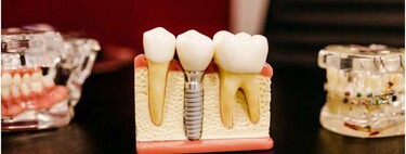 La IA ayuda a identificar a las personas que están en riesgo de pérdida de dientes sin la necesidad de un examen dental