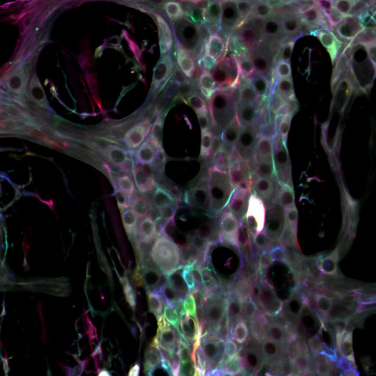 Nuestro ‘segundo cerebro’ no solo existe, sino que podría funcionar aunque se desconectara del nuestro sistema nervioso central