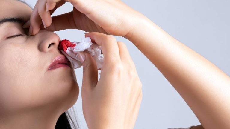 4 signos de deficiencia de vitamina K que la mayoría de las personas ignoran
