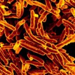 imagen_de_microscopio_de_la_bacteria_mycobacterium_tuberculosis._niaid_wikimedia_commons-300×241-1