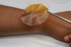 Imagen del nuevo apósito desarrollado por el ICMM-CSIC. Crédito Ángela Bonachera Crean apósitos que se activan con la luz solar para frenar la expansión de las infecciones bacterianas