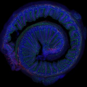 Intestino 2 dapi Ejercicio moderado, microbiota y memoria: Un trío inesperado para la salud cerebral
